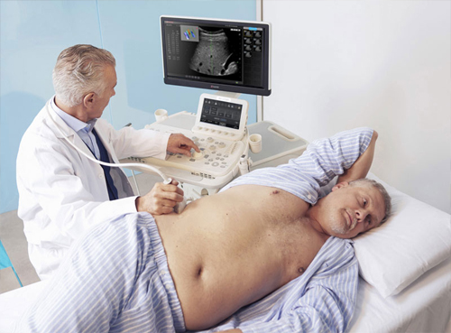 Elastography