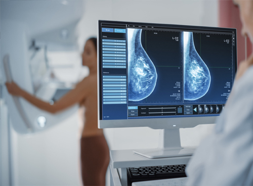Mammography
